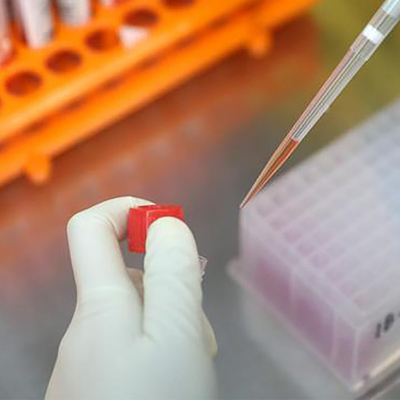 संक्रामक रोग मंकीपॉक्स वायरस टेस्ट रैपिड आईजीएम आईजीजी कोलाइडल गोल्ड